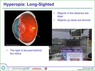 Introduction to Refractive Eye Surgery | PPT