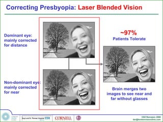 Eye Distance Surgery Introduction to Refractive Eye Surgery | PPT
