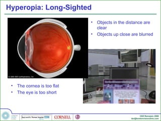 Eye Distance Surgery Introduction to Refractive Eye Surgery | PPT