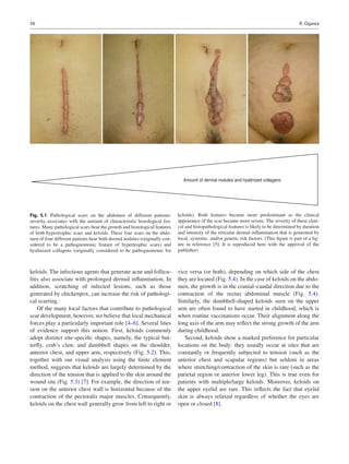 Scar Contracture Example Rei Ogawa - Total Scar Management_ From Lasers to Surgery for Scars ...