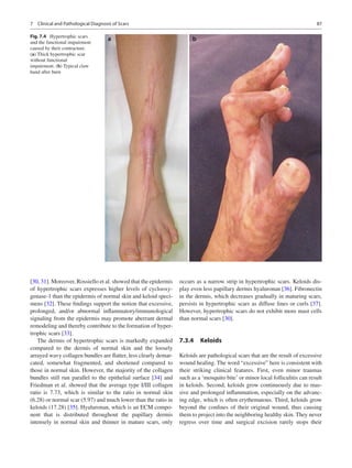 Rei Ogawa - Total Scar Management_ From Lasers to Surgery for Scars ...