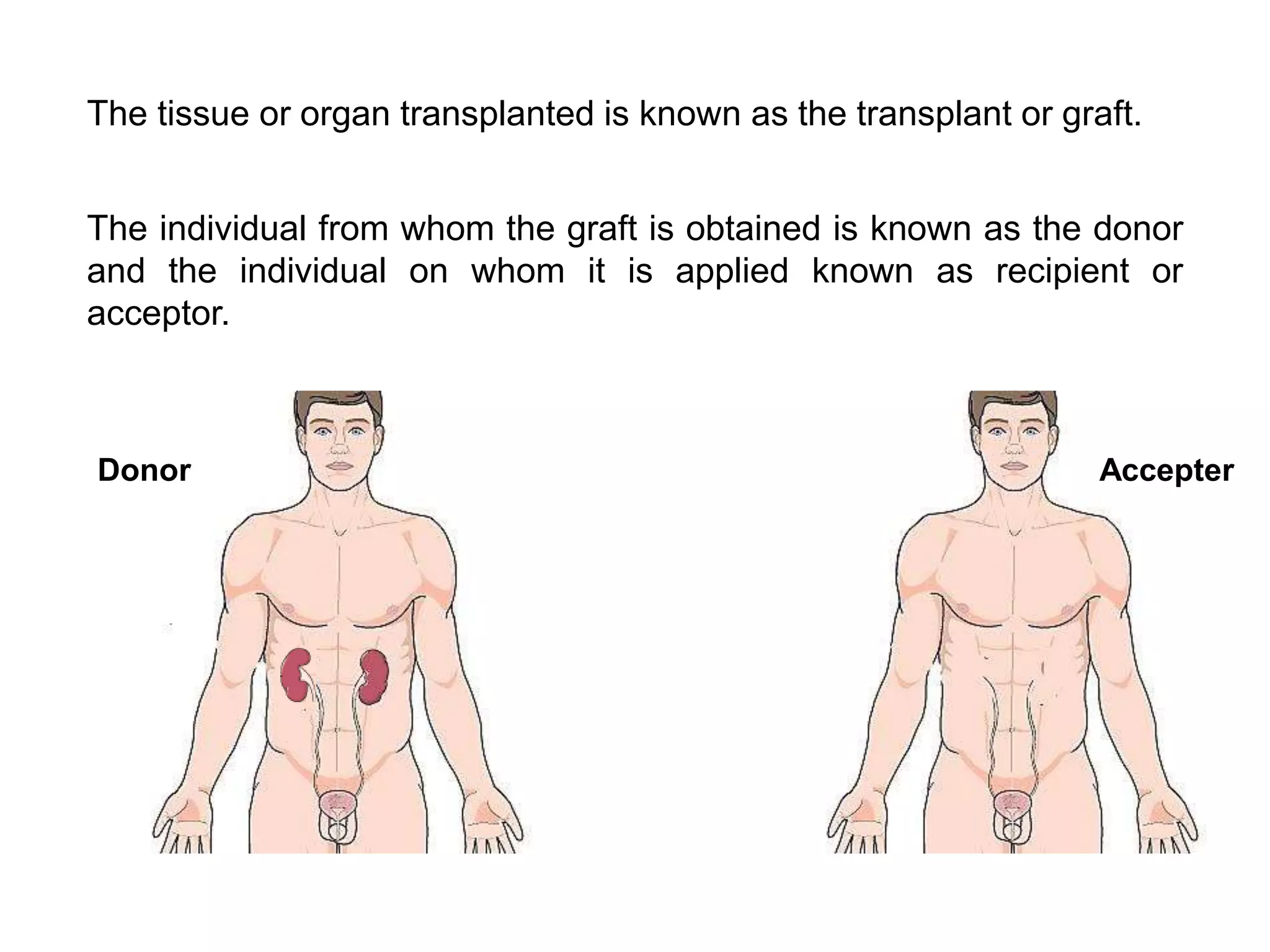 Rejected Organs Organ Transplantation and rejection | PPTX