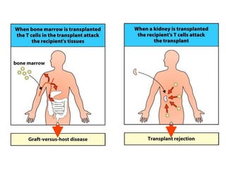 Rejected Organs Organ Transplantation and rejection | PPTX