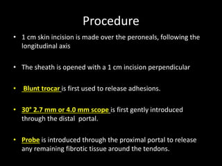 Procedure
• 1 cm skin incision is made over the peroneals, following the
longitudinal axis
• The sheath is opened with a 1 cm incision perpendicular
• Blunt trocar is first used to release adhesions.
• 30° 2.7 mm or 4.0 mm scope is first gently introduced
through the distal portal.
• Probe is introduced through the proximal portal to release
any remaining fibrotic tissue around the tendons.
 