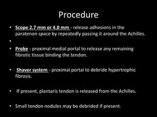 Procedure
• Scope 2.7 mm or 4.0 mm - release adhesions in the
paratenon space by repeatedly passing it around the Achilles.
•
• Probe - proximal medial portal to release any remaining
fibrotic tissue binding the tendon.
• Shaver system - proximal portal to debride hypertrophic
fibrosis.
• If present, plantaris tendon is released from the Achilles.
• Small tendon nodules may be debrided if present.
 
