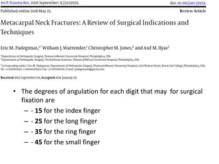 • The degrees of angulation for each digit that may for surgical
fixation are
– - 15 for the index finger
– - 25 for the long finger
– - 35 for the ring finger
– - 45 for the small finger
 
