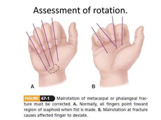Assessment of rotation.
 