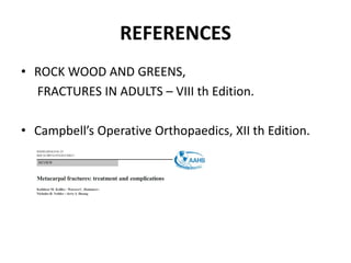 REFERENCES
• ROCK WOOD AND GREENS,
FRACTURES IN ADULTS – VIII th Edition.
• Campbell’s Operative Orthopaedics, XII th Edition.
 