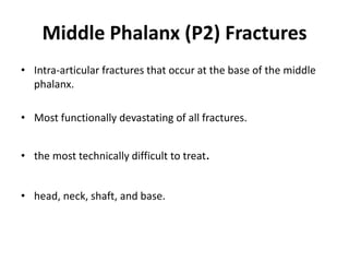 Middle Phalanx (P2) Fractures
• Intra-articular fractures that occur at the base of the middle
phalanx.
• Most functionally devastating of all fractures.
• the most technically difficult to treat.
• head, neck, shaft, and base.
 