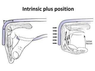 Intrinsic plus position
 