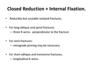 Closed Reduction + Internal Fixation.
• Reducible but unstable isolated fractures.
• For long oblique and spiral fractures
– three K-wires- perpendicular to the fracture
• For neck fractures-
– retrograde pinning may be necessary
• For short oblique and transverse fractures,
– longitudinal K-wires .
 