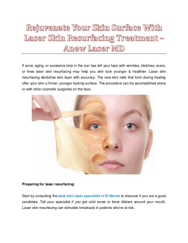 Rejuvenate Your Skin Surface With Laser Skin Resurfacing Treatment