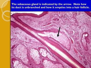 The sebaceous gland is indicated by the arrow.  Note how its duct is unbranched and how it empties into a hair follicle. 