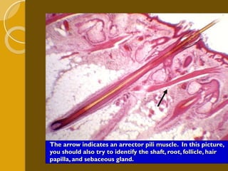 The arrow indicates an arrector pili muscle.  In this picture, you should also try to identify the shaft, root, follicle, hair papilla, and sebaceous gland. 