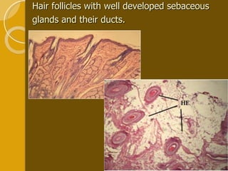Hair follicles with well developed sebaceous glands and their ducts.   