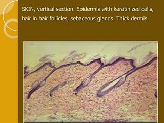 SKIN, vertical section. Epidermis with keratinized cells, hair in hair follicles, sebaceous glands. Thick dermis.   