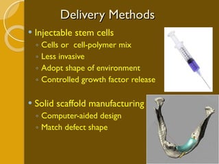 Delivery Methods Injectable stem cells Cells or  cell-polymer mix Less invasive Adopt shape of environment Controlled growth factor release Solid scaffold manufacturing Computer-aided design Match defect shape 