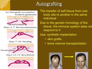 Autografting The transfer of self tissue from one body site to another in the same individual Due to the genetic homology of the tissue, the immune system does not respond to it Use: synthetic implantation skin grafts bone marrow transplantation 