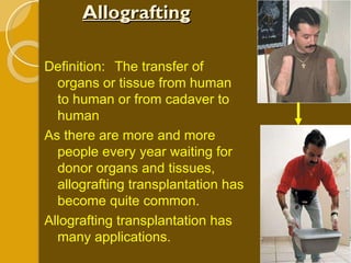 Allografting Definition: The transfer of organs or tissue from human to human or from cadaver to human As there are more and more people every year waiting for donor organs and tissues, allografting transplantation has become quite common. Allografting transplantation has many applications. 