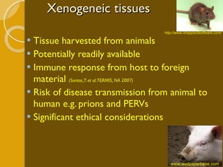 Xenogeneic tissues Tissue harvested from animals Potentially readily available Immune response from host to foreign material  (Santos, T. et al. TERMIS, NA 2007) Risk of disease transmission from animal to human e.g. prions and PERVs Significant ethical considerations www.wallpaperbase.com  http://www.sheppardsoftware.com/ 