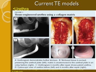 Current TE models Urethra Atala et al. A novel inert collagen matrix for hypospadias repair. (1999) J Urol. 162(3 pt 2):1148-1151 