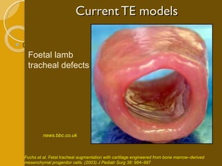 Current TE models Cartilage news.bbc.co.uk  Foetal lamb tracheal defects Fuchs et al. Fetal tracheal augmentation with cartilage engineered from bone marrow–derived mesenchymal progenitor cells. (2003) J Pediatr Surg 38: 984–987 