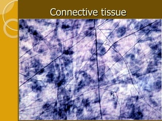 Connective tissue 