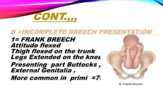 breech presentation | PPTX