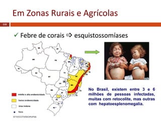 Em Zonas Rurais e Agrícolas
110
 Febre de corais  esquistossomíases
No Brasil, existem entre 3 e 6
milhões de pessoas infectadas,
muitas com retocolite, mas outras
com hepatoesplenomegalia.
 
