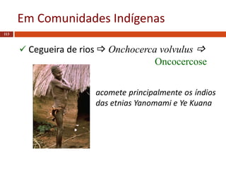 Em Comunidades Indígenas
113
 Cegueira de rios  Onchocerca volvulus 
Oncocercose
acomete principalmente os índios
das etnias Yanomami e Ye Kuana
 