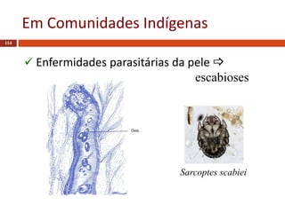 Em Comunidades Indígenas
114
 Enfermidades parasitárias da pele 
escabioses
Sarcoptes scabiei
 