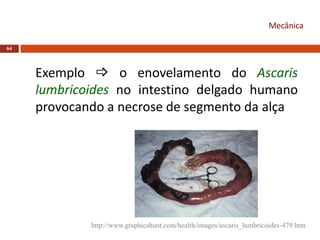 64
Exemplo  o enovelamento do Ascaris
lumbricoides no intestino delgado humano
provocando a necrose de segmento da alça
Mecânica
http://www.graphicshunt.com/health/images/ascaris_lumbricoides-479.htm
 