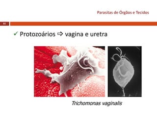 81
 Protozoários  vagina e uretra
Trichomonas vaginalis
Parasitas de Órgãos e Tecidos
 