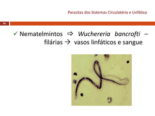 Parasitas dos Sistemas Circulatório e Linfático
86
 Nematelmintos  Wuchereria bancrofti –
filárias  vasos linfáticos e sangue
 