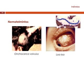 Indiretos
93
Nematelmintos
Onchocerca volvulus Loa loa
 