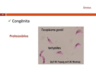 Diretos
97
 Congênita
Protozoários
 