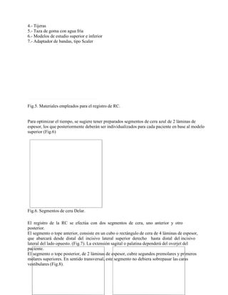 7.- Adaptador de bandas, tipo Scaler

Fig.5. Materiales empleados para el registro de RC.

Para optimizar el tiempo, se sugiere tener preparados segmentos de cera azul de 2 láminas de
espesor, los que posteriormente deberán ser individualizados para cada paciente en base al modelo
superior (Fig.6)

Fig.6. Segmentos de cera Delar.
El registro de la RC se efectúa con dos segmentos de cera, uno anterior y otro
posterior.
El segmento o tope anterior, consiste en un cubo o rectángulo de cera de 4 láminas de espesor,
que abarcará desde distal del incisivo lateral superior derecho hasta distal del incisivo
lateral del lado opuesto. (Fig.7). La extensión sagital o palatina dependerá del overjet del
paciente.
El segmento o tope posterior, de 2 láminas de espesor, cubre segundos premolares y primeros
molares superiores. En sentido transversal, este segmento no debiera sobrepasar las caras
vestibulares (Fig.8).

 