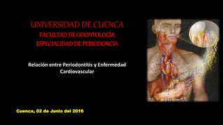 UNIVERSIDAD DE CUENCA
FACULTADDE ODONTOLOGÍA
ESPECIALIDADDE PERIODONCIA
Relación entre Periodontitis y Enfermedad
Cardiovascular
Cuenca, 02 de Junio del 2016
 