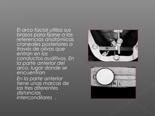  El arco facial utiliza sus
brazos para fijarse a las
referencias anatómicas
craneales posteriores a
través de olivas que
entran en los
conductos auditivos. En
la parte anterior del
arco, lugar donde se
encuentran
 En la parte anterior
tiene unas marcas de
las tres diferentes
distancias
intercondilares .
 
