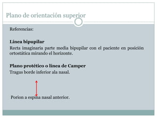 Plano de orientación superior

 Referencias:

 Línea bipupilar
 Recta imaginaria parte media bipupilar con el paciente en posición
 ortostática mirando el horizonte.

 Plano protético o línea de Camper
 Tragus borde inferior ala nasal.




 Porion a espina nasal anterior.
 