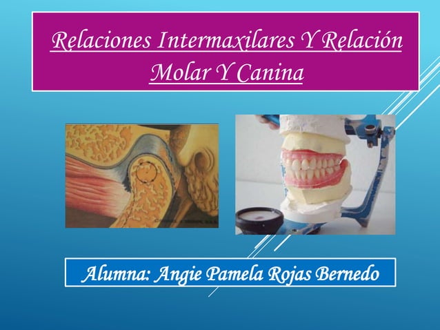 Relaciones intermaxilares y relación molar y canina [recuperado] | PPTX