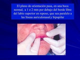 Labio Reposo RELACION INTERMAXILAR , VERTICAL Y HORIZONTAL.ppt