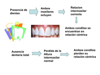 relacion intermaxilares protesis univ.ppt