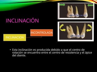 RELACION MOMENTO FUERZA EN ORTODONCIA Uribe.pptx
