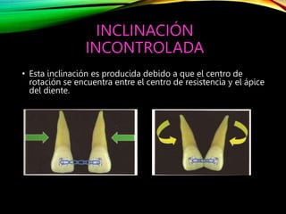 RELACION MOMENTO FUERZA EN ORTODONCIA Uribe.pptx