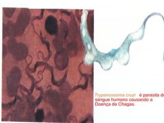Trypanossoma cruzi é parasita do
sangue humano causando a
Doença de Chagas.
 