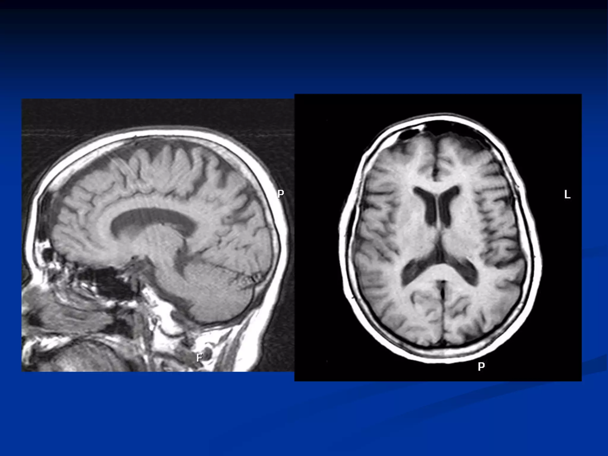 RNM Relajacion y potenciacion 885