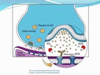 Access Anesthesiology McGraw-Hill Lange 
Chapter 9 Neuromuscular blocking agents. 
 
