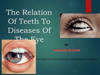 The Relation
Of Teeth To
Diseases Of
The Eye
BY/
MOHAMED ELSHAFIE
LECTURER OF OPHTHALMOLOGY KAFRELSHIEKH UNIVERSITY
 