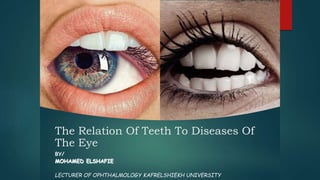 The Relation Of Teeth To Diseases Of
The Eye
BY/
MOHAMED ELSHAFIE
LECTURER OF OPHTHALMOLOGY KAFRELSHIEKH UNIVERSITY
 